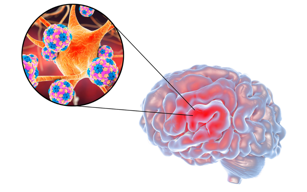 Image of a brain with a zoom in on one part to show a virus.